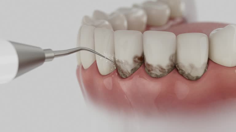 Trusted Root Canal Treatment service in Cinco Ranch, TX - Dentist Open Now